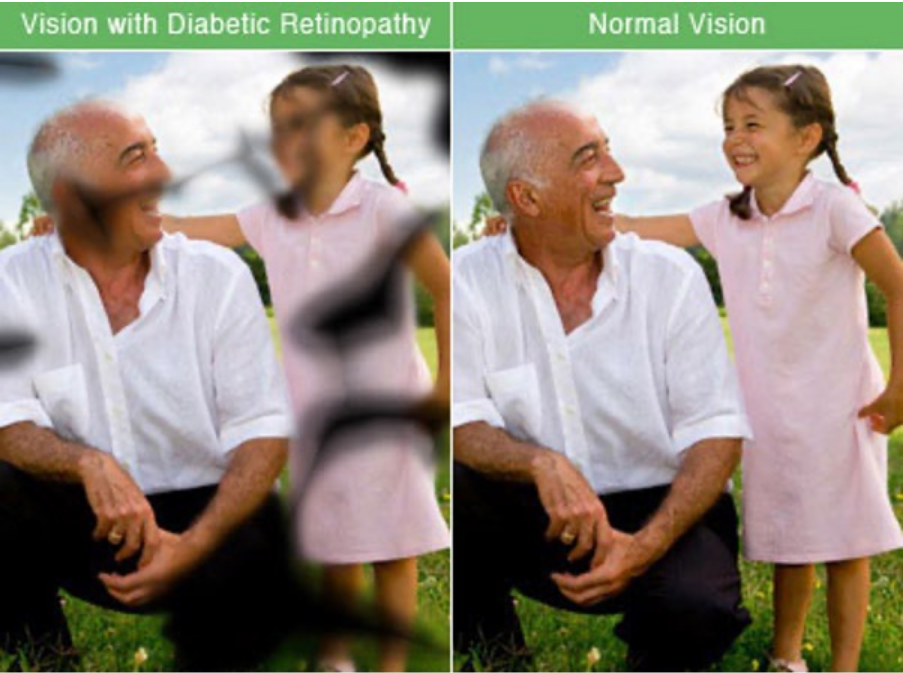 Vision Comparision